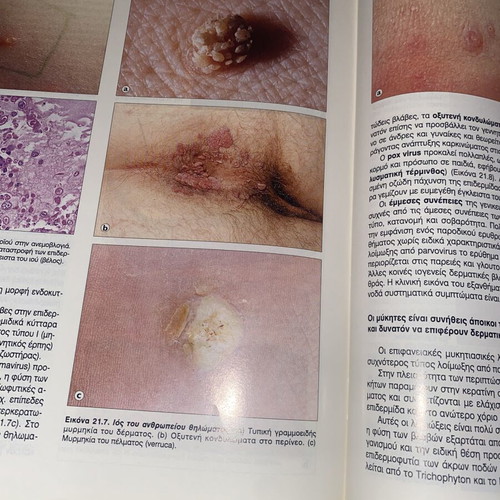 Pathological Anatomy book by Stevens, Lowe, Davaris