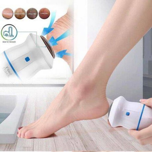 Device for Removing Rough Skin on Heels and Hands new