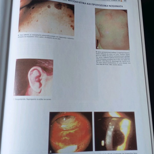 Nosologia volumes 1, 2 and 3 like new, medical books