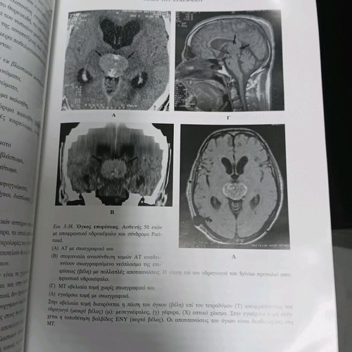 Clinical and Radiological Study used