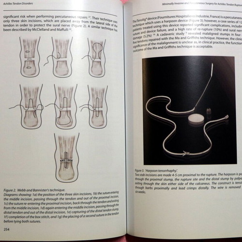 Achilles Tendon Disorders new, English medical textbook
