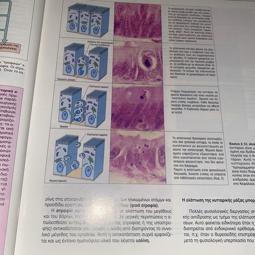 Pathological Anatomy book by Stevens, Lowe, Davaris