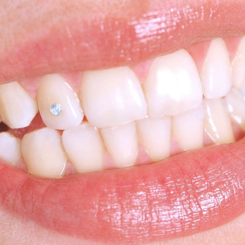 Swarovski dental crystal new, transparent 1.7 millimeters