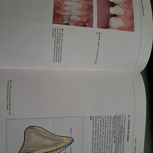 All-Ceramic Aesthetic Restorations book like new