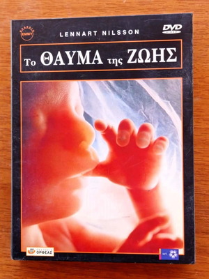 DVD Case The Miracle of Life like new