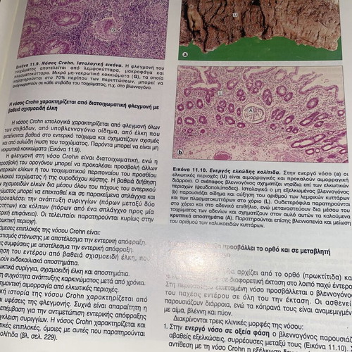 Pathological Anatomy book by Stevens, Lowe, Davaris