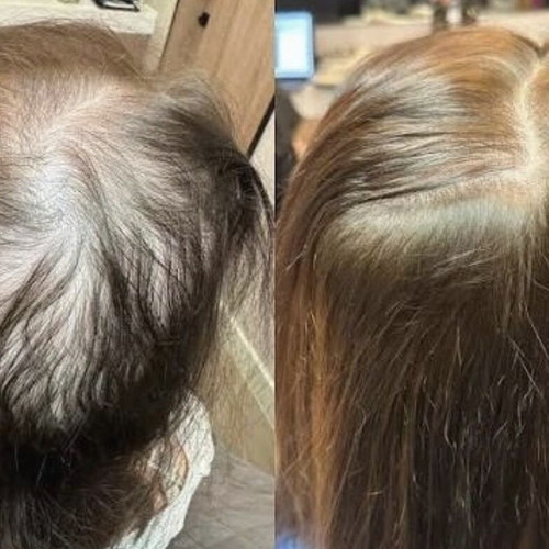 Hair oil new with 9 natural oils for healthy long hair