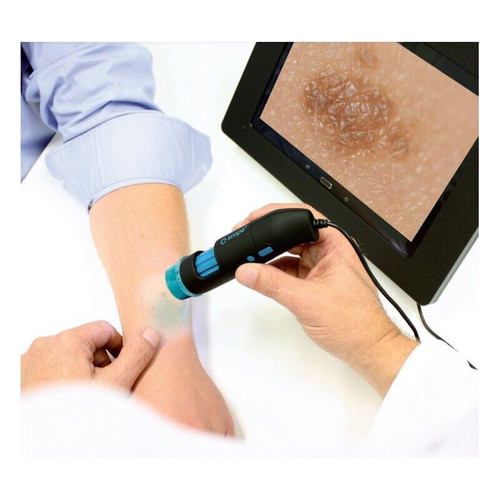 Digital hand microscope QS.DERMO new