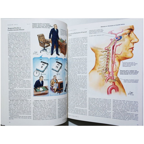 The Ciba Collection of Medical Illustrations like new, Nervous system, Netter