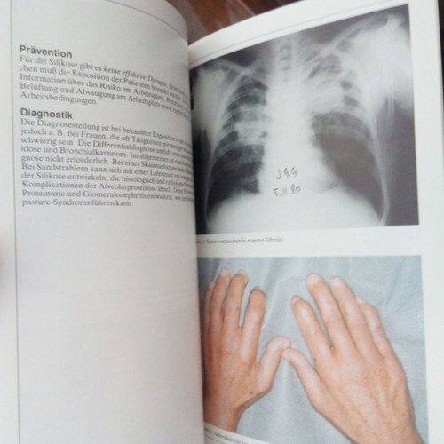 Pneumonologie medical book like new, in German