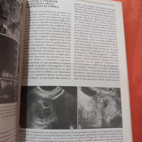 Gli ultrasuoni e le tube di Falloppio book used, Italian