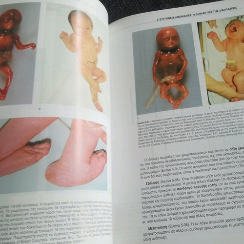 Colored Clinical Embryology University Medical Textbook AUTH like new