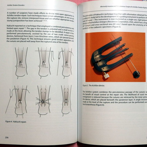 Achilles Tendon Disorders new, English medical textbook