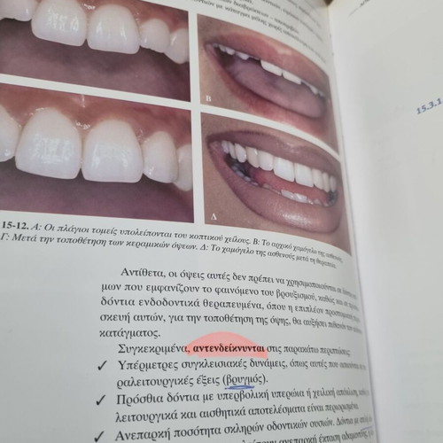 Clinical Aesthetic Dentistry used, Gerasimos P. Douvitsas