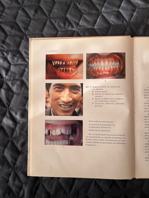 Teeth Whitening Book like new, Gerasimos Douvitsas