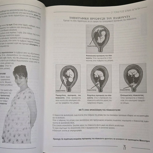 O Toketos Einai Agapi book like new