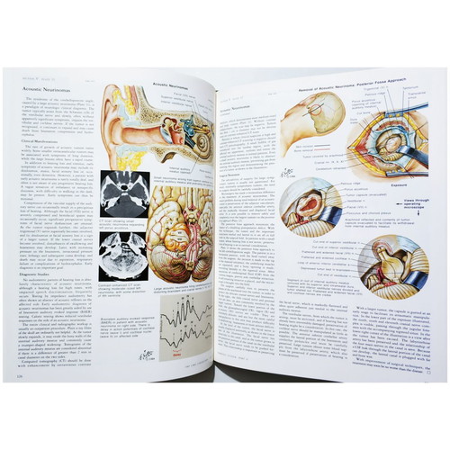 The Ciba Collection of Medical Illustrations like new, Nervous system, Netter