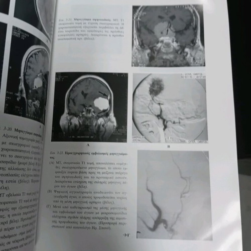 Clinical and Radiological Study used
