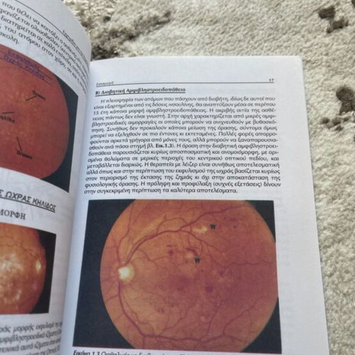 Ophthalmology book manual for low vision new