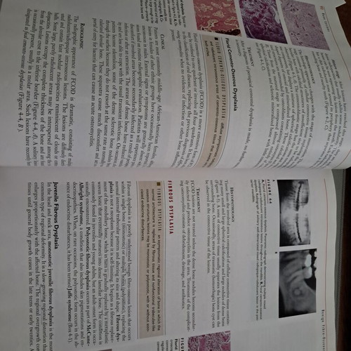 Contemporary Oral and Maxillofacial Pathology book, like new