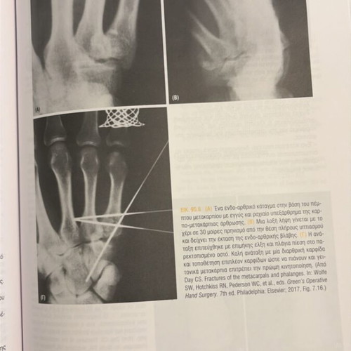 Basic Orthopedics book new, Greek