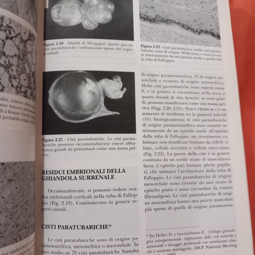 Gli ultrasuoni e le tube di Falloppio book used, Italian