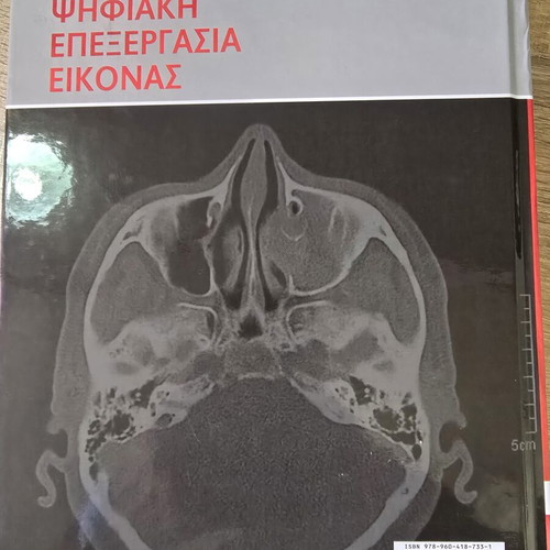 Digital Image Processing 4th Edition book like new, Greek