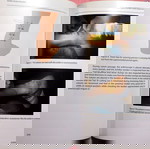  Achilles Tendon Disorders (Διαταραχές του Αχίλλειου τένοντα)