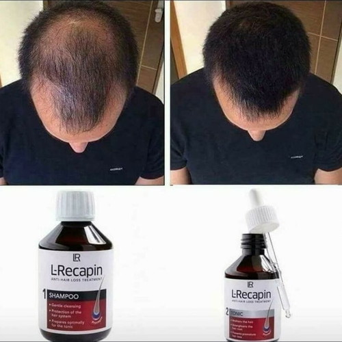 L-Recapin Set for Hereditary Hair Loss New