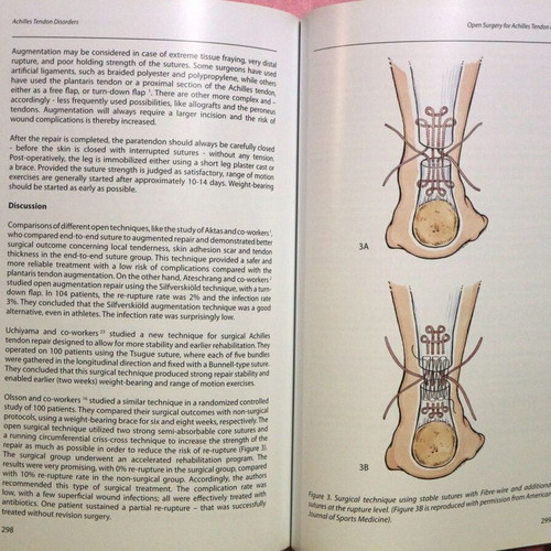 Achilles Tendon Disorders new, English medical textbook