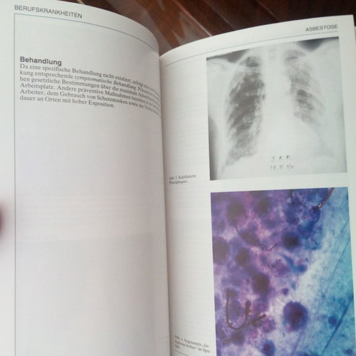 Pneumonologie medical book like new, in German