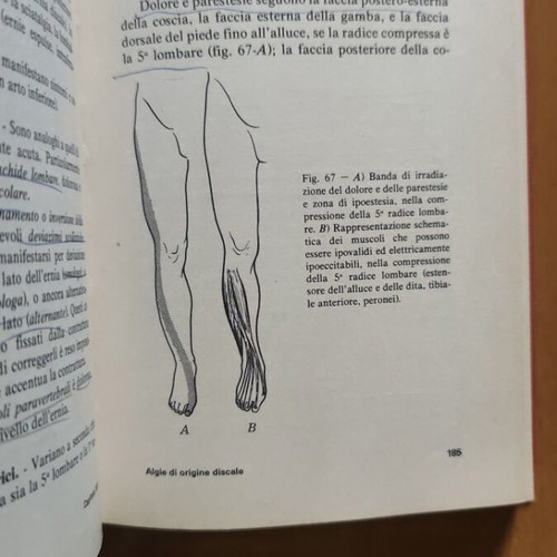 Lezioni di Clinica Ortopedica medical book by Mario Campanacci