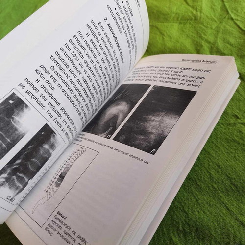 Osteoporosis book like new, 2004, scientific medical guide