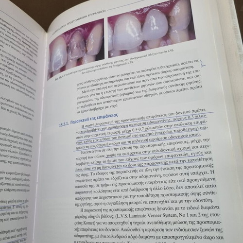 Clinical Aesthetic Dentistry used, Gerasimos P. Douvitsas