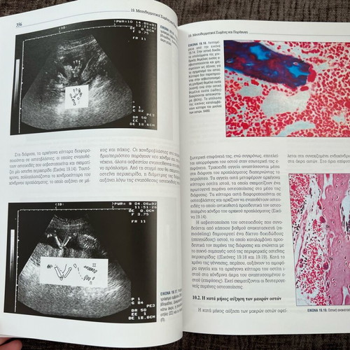 Embryology Roxani Angelopoulou like new