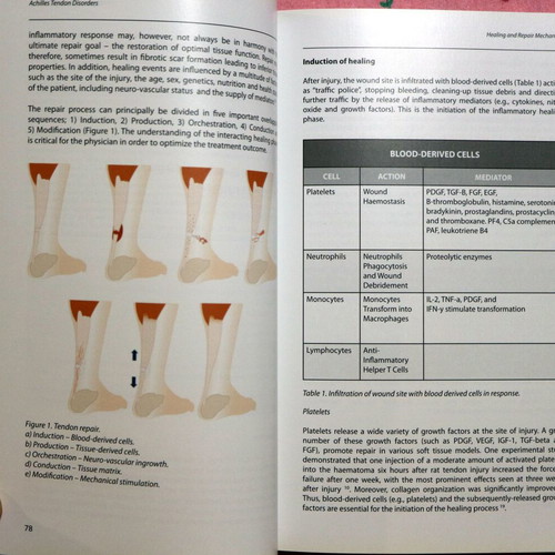 Achilles Tendon Disorders new, English medical textbook