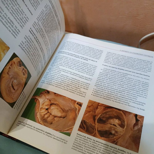 Pathological Anatomy like new