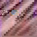  δαχτυλίδι