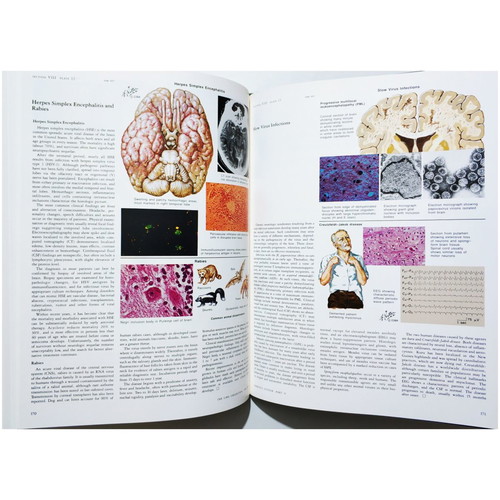 The Ciba Collection of Medical Illustrations like new, Nervous system, Netter