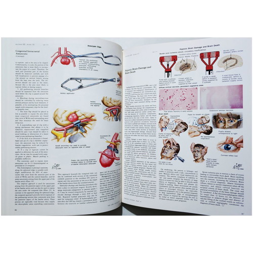 The Ciba Collection of Medical Illustrations like new, Nervous system, Netter
