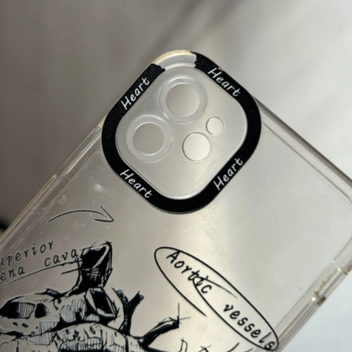 Aortic vessels iPhone 11 phone case used