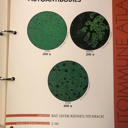 Autoimmune Diseases Atlas book used