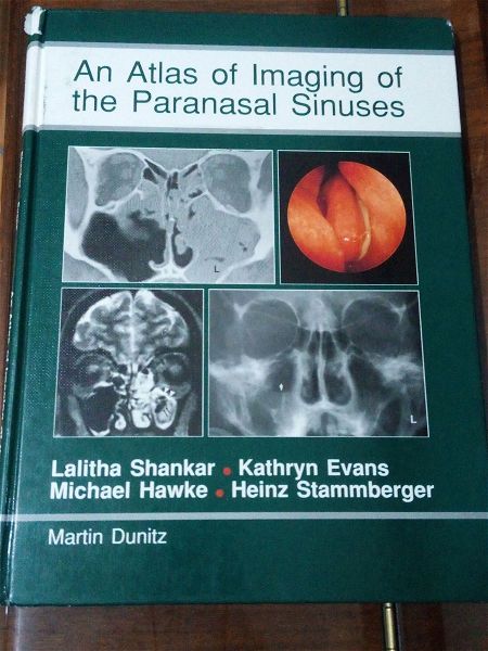  An Atlas of Imaging of the Paranasal Sinuses, Lalitha Shankar (atlas apikonistikis ton pararinion ke splachnikou kraniou)