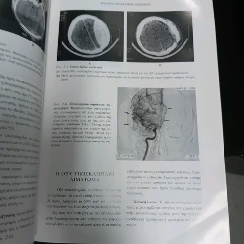 Clinical and Radiological Study used