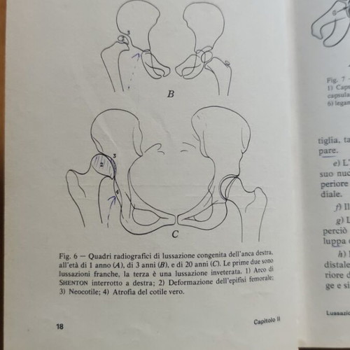 Lezioni di Clinica Ortopedica medical book by Mario Campanacci