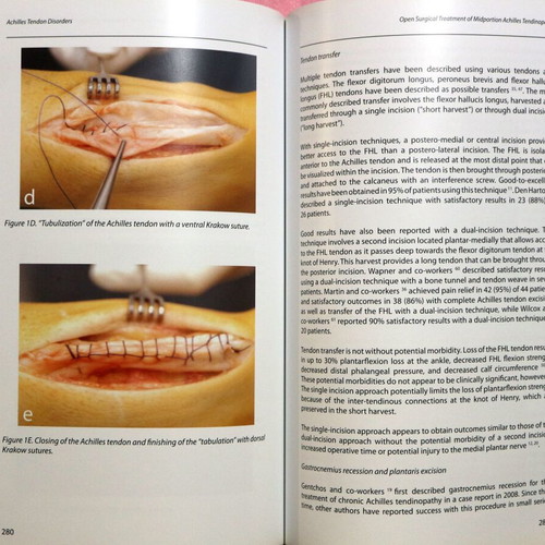 Achilles Tendon Disorders new, English medical textbook