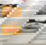  Achilles Tendon Disorders (Διαταραχές του Αχίλλειου τένοντα)