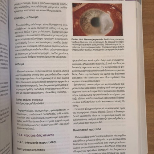 Pathological Anatomy Bocker Volume 1 new condition, includes volumes 1-2