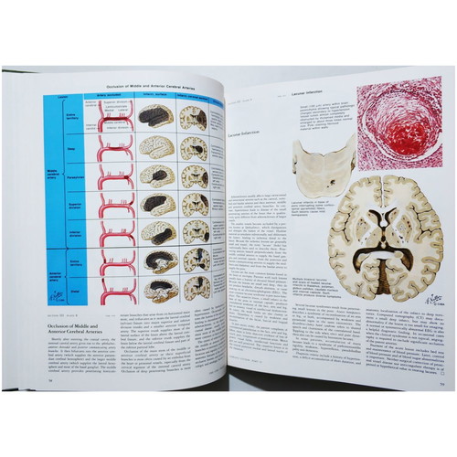 The Ciba Collection of Medical Illustrations like new, Nervous system, Netter