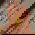  Allover δαχτυλίδι